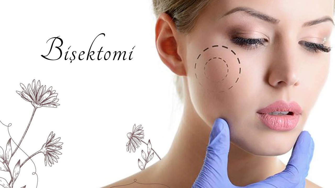 Bişektomi ile Zarif ve İnce Yüz Hatlarına Sahip Olun