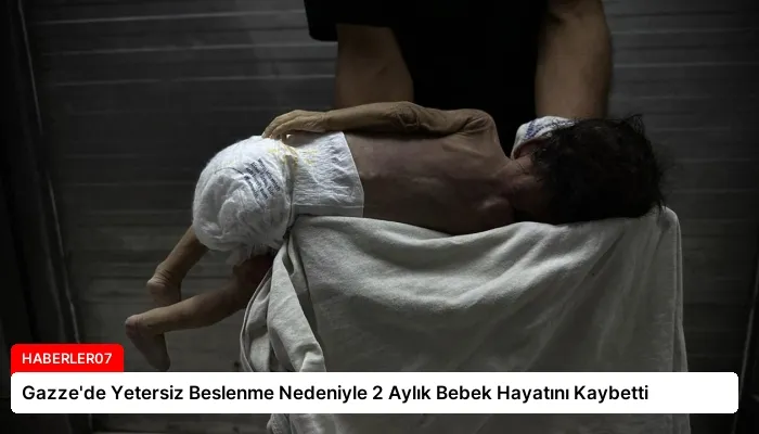 Gazze’de Yetersiz Beslenme Nedeniyle 2 Aylık Bebek Hayatını Kaybetti