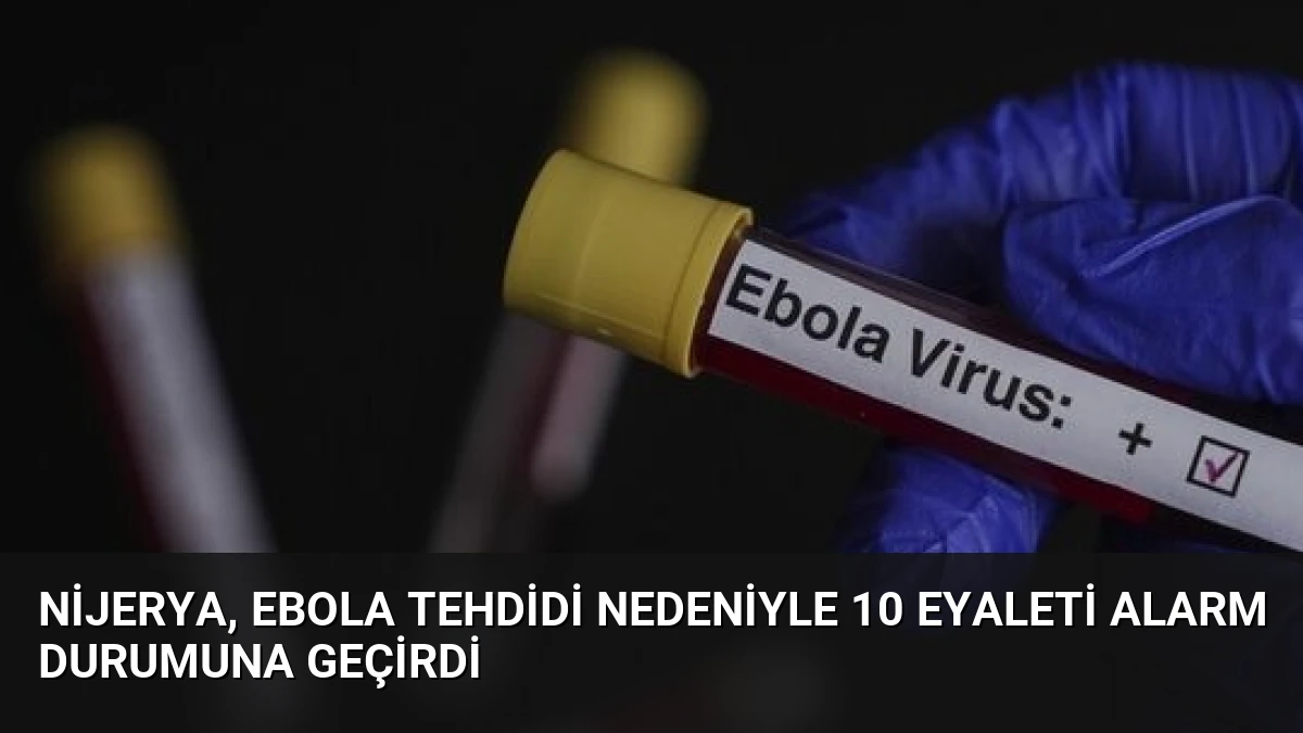 Nijerya, Ebola Tehdidi Nedeniyle 10 Eyaleti Alarm Durumuna Geçirdi